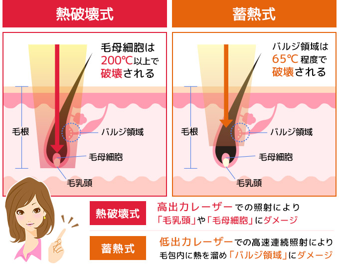 熱破壊式と蓄熱式